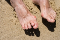 Causes and Treatment for Hammertoe