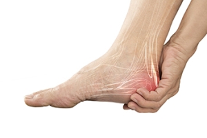 Distinct Differences Between Heel Spurs and Plantar Fasciitis